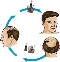 Fue Hair Transplant logo