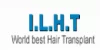 International Laser Hair Transplant